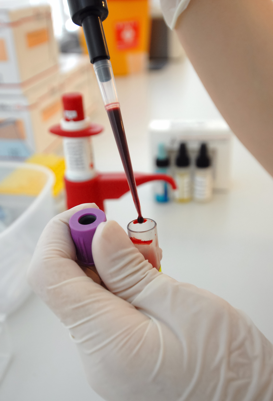 A blood test